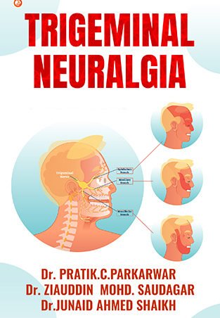 Trigeminal Neuralgia | OrangeBooks Publication