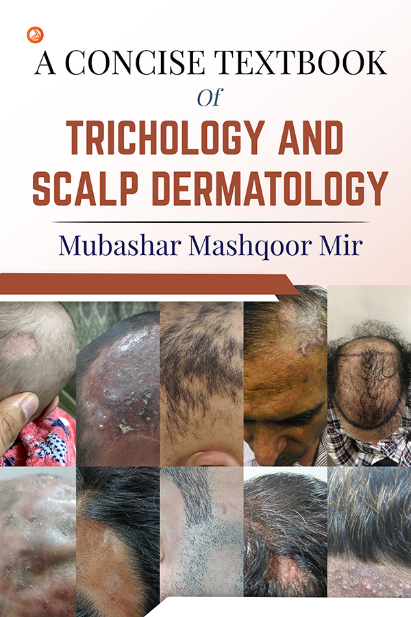 A Concise Textbook Of Trichology And Scalp Dermatology Wissen Bookstore